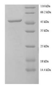 SDS-PAGE (CHMP2A-5210H).jpg